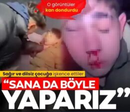 Sağır ve dilsiz çocuğa işkence: 3 kişi tutuklandı